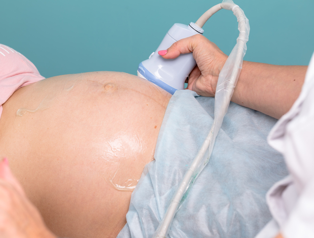 妊婦検診　超音波