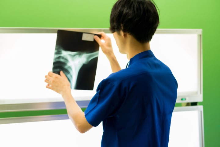 肩を怪我した人のレントゲンを見ている医師の画像
