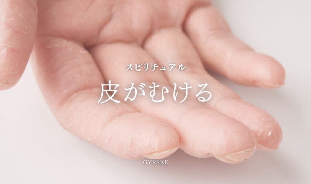 【スピリチュアル】手・足・指の皮がむける・手荒れの意味とは