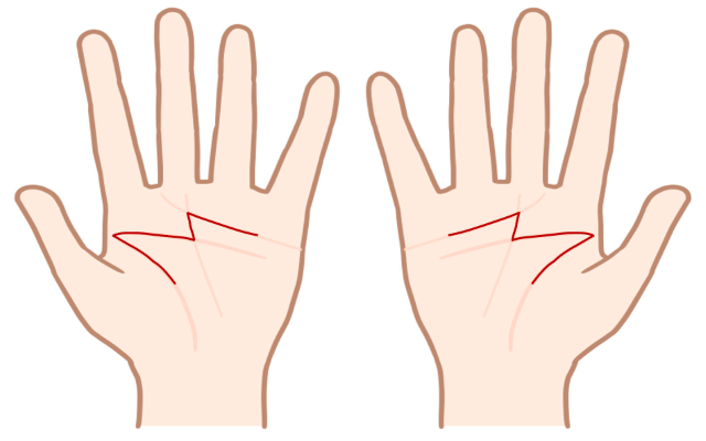 手相占い ラッキーm線の意味を解説 実はみんなある 画像あり